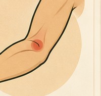 Inner elbow crease