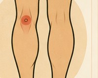 Back of the knee
