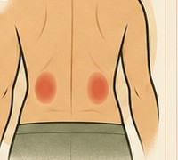 Low back over the kidneys